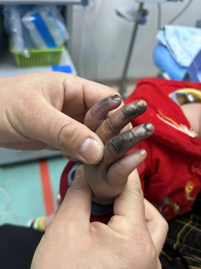 3岁男孩小区内身亡这个设施很常见！家长一定注意尊龙凯时app网站“脚后跟碰到就倒了下去”1(图4)