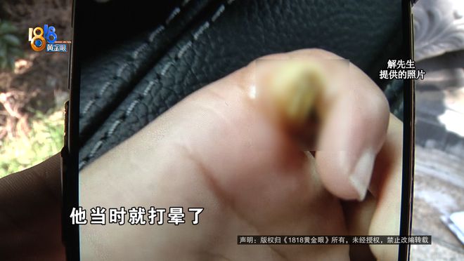 筋都断了……街头常见看见立即远离！人生就是搏后怕！5岁男童瞬间晕厥