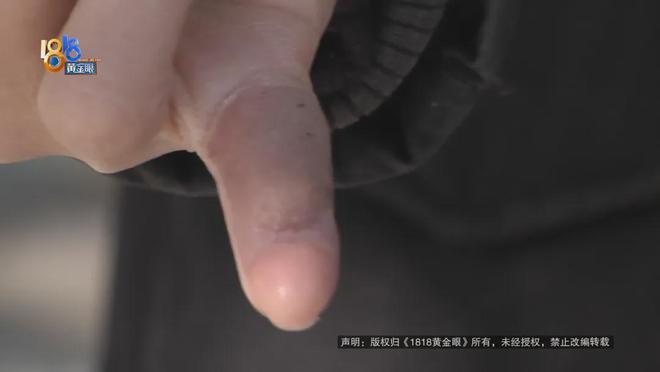 筋都断了……街头常见看见立即远离！人生就是搏后怕！5岁男童瞬间晕厥(图7)