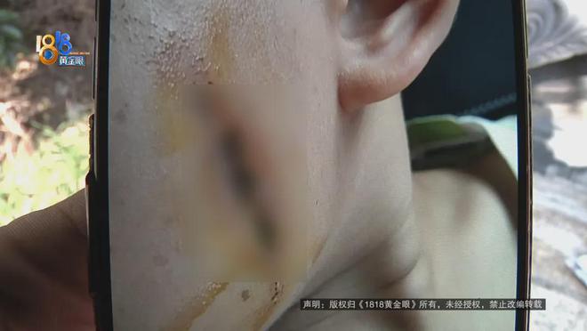 筋都断了……街头常见看见立即远离！人生就是搏后怕！5岁男童瞬间晕厥(图5)